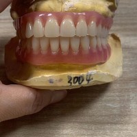 Full Denture  Lab Denture