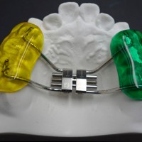 深圳义齿工厂 直接3D打印透明牙套 透明牙套矫治器