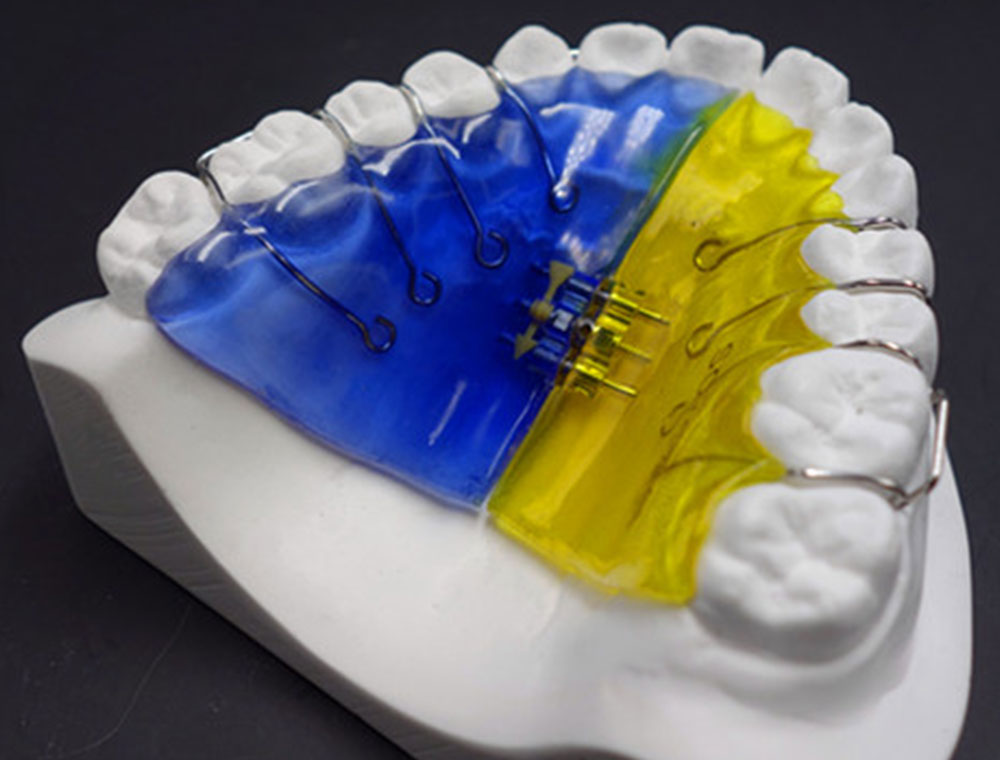 深圳义齿工厂隐形支架 牙科3D打印机直接打印出隐形透明矫正器