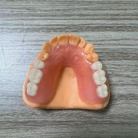 中国深圳3D打印正畸牙套工厂