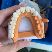 德国国际假牙出口工厂义齿厂家外贸  德国义齿加工